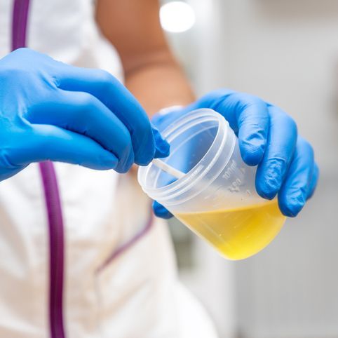 Urine Test