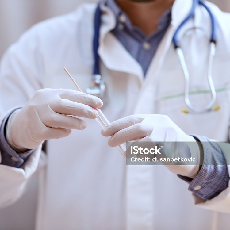 Rapid Flu Test (Antigen)